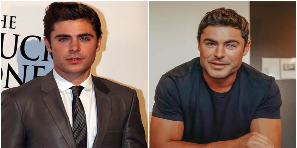 The real reason for Zac Efron's "new face" was revealed by Dr. Anthony Youn
