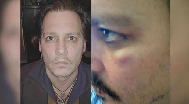 Johnny Depp was brutally beaten by his ex-wife