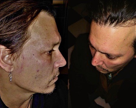 Johnny Depp was brutally beaten by his ex-wife