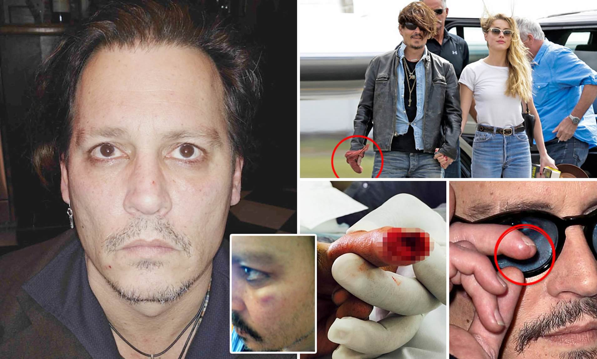 Johnny Depp was brutally beaten by his ex-wife