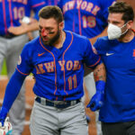 MLB player Kevin Pillar is hit in the face by a 94 MPH fastball