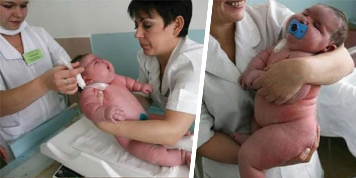 The biggest baby in history weighs 18 kilos and was born in Australia