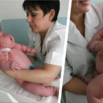 The biggest baby in history weighs 18 kilos and was born in Australia