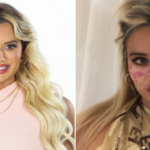 Influencer lost vision and was left with scars after trying out a TikTok 'trick'