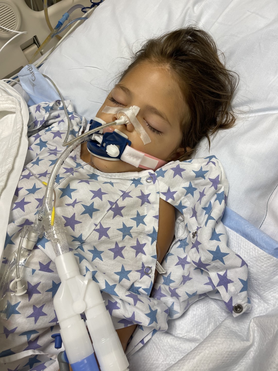 5-year-old girl is fighting for her life after being bitten by a snake