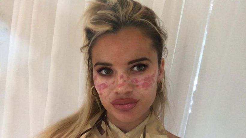 Influencer lost vision and was left with scars after trying out a TikTok 'trick'