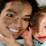He paints his face the same as his son's birthmark to support him