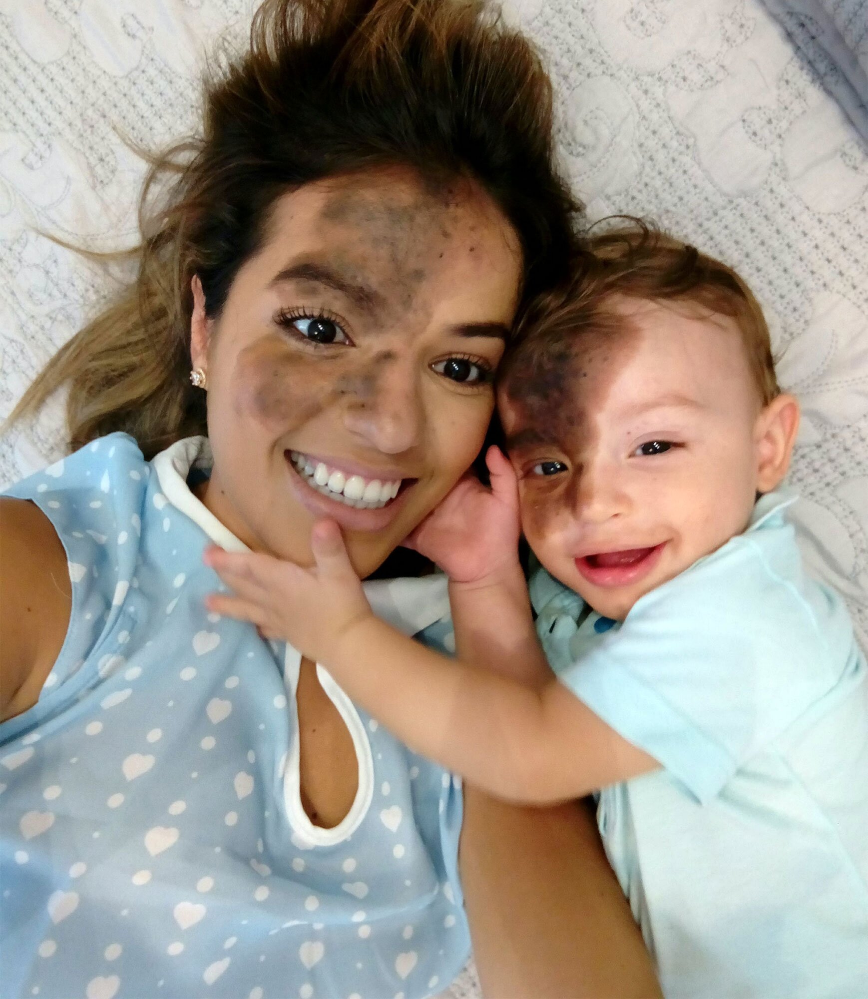 He paints his face the same as his son's birthmark to support him