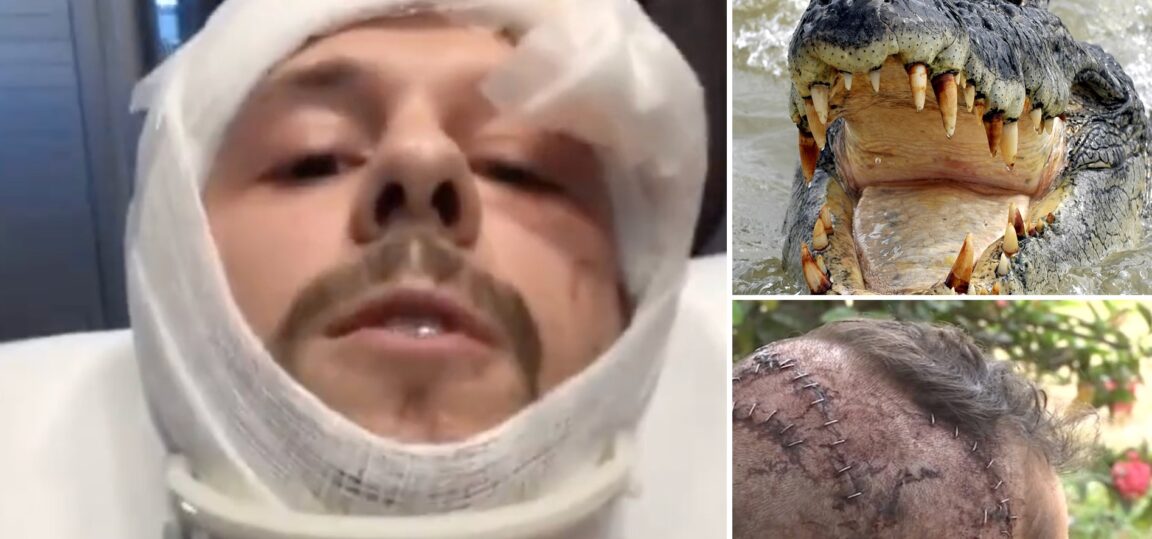Man suffers horrific injuries after being mauled by a 9-foot alligator
