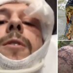 Man suffers horrific injuries after being mauled by a 9-foot alligator