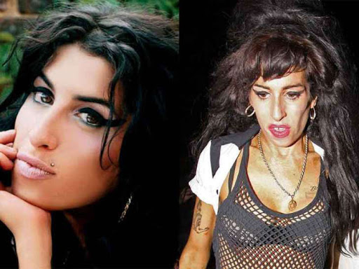 Amy Winehouse: The Before and After of Drugs and Alcohol