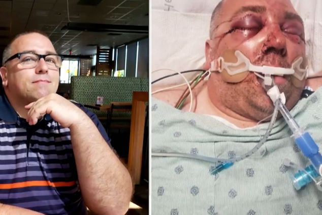 Man 'beaten into coma' after asking neighbors to turn down music volume