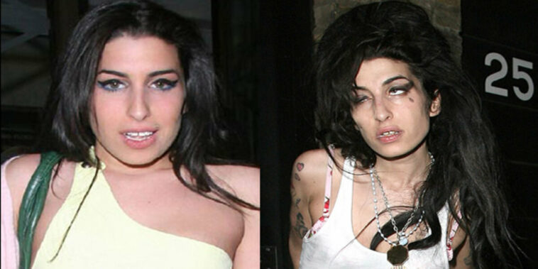 Amy Winehouse: The Before and After of Drugs and Alcohol