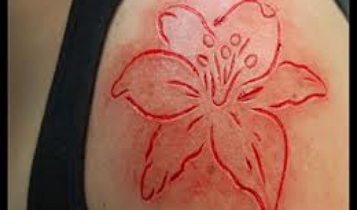 Scarification: underground fashion coming from the USA