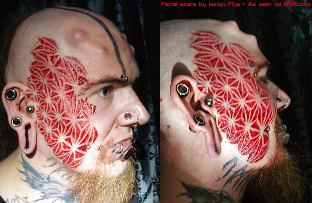 Scarification: underground fashion coming from the USA