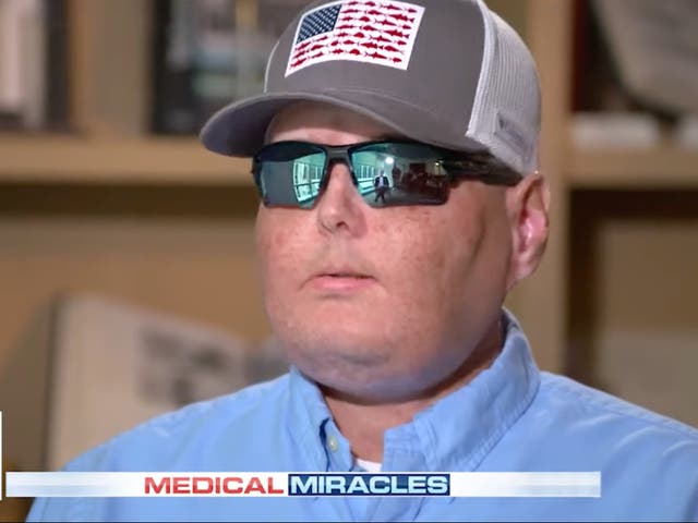 Man who underwent world's most extensive face transplant operation reveals how it has changed his life