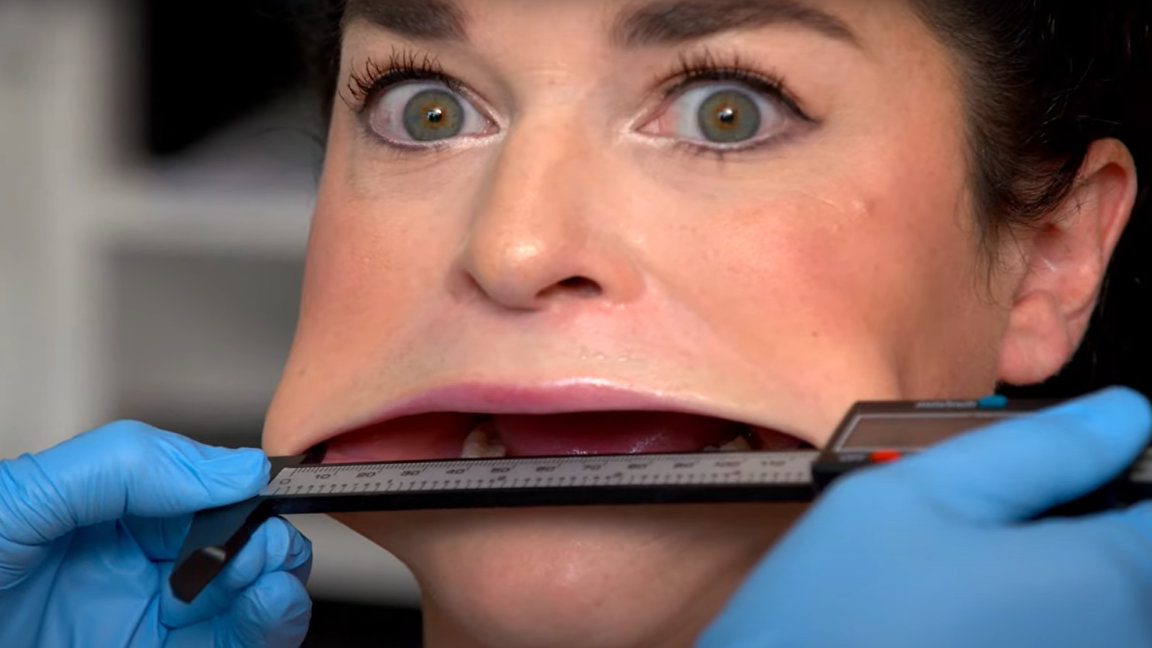 Samantha Ramsdell, the Guinness World Record holder for largest mouth in the world