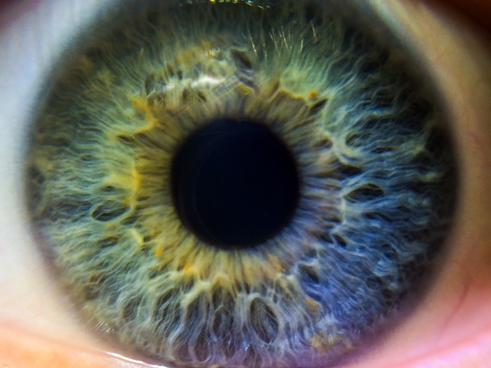 Why do eyes have color? Maybe you've asked yourself this question once.