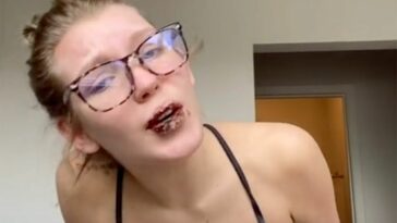 This woman's lips went from bad to worse after contracting COVID-19 while taking Accutane