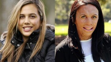 Turia Pitt, from surviving a fire to the cover of a magazine