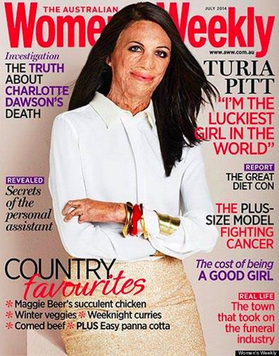 Turia Pitt, from surviving a fire to the cover of a magazine