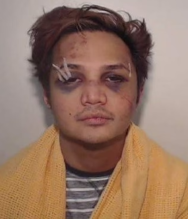 A rapist is pictured covered in cuts and bruises after one of his victims fought back