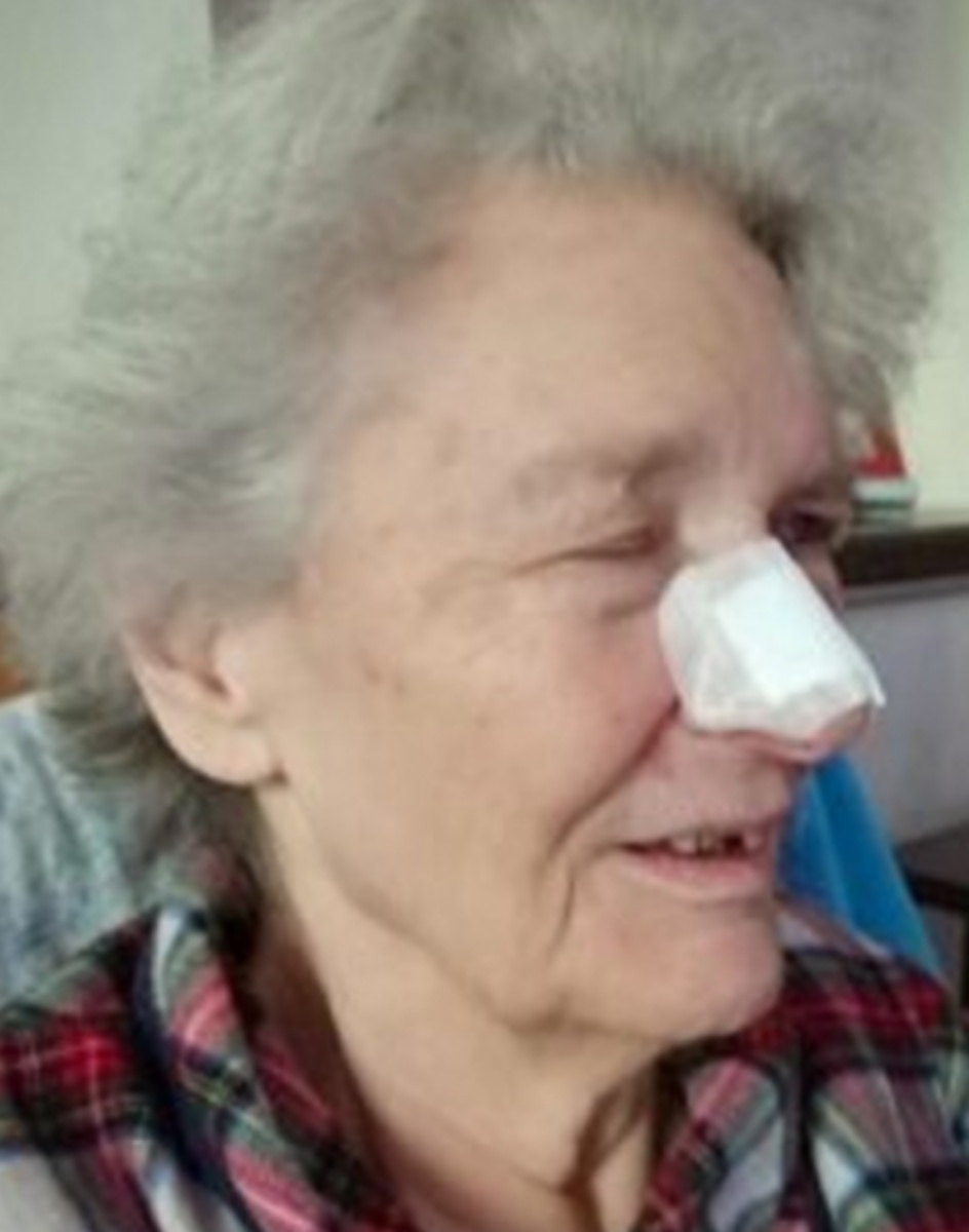 Elderly woman bitten in bed by a rat while sleeping