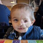 Boy has face ripped off after dog attack: other kids call him a monster