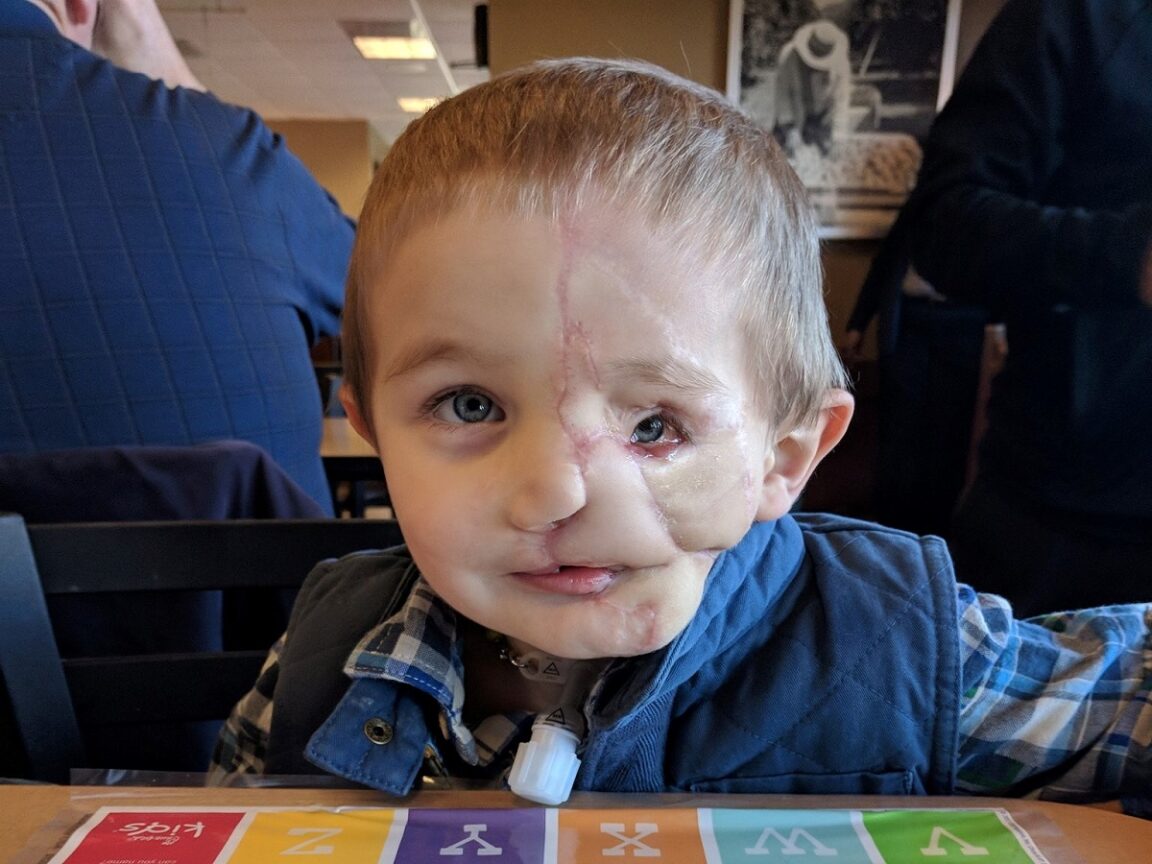 Boy has face ripped off after dog attack: other kids call him a monster